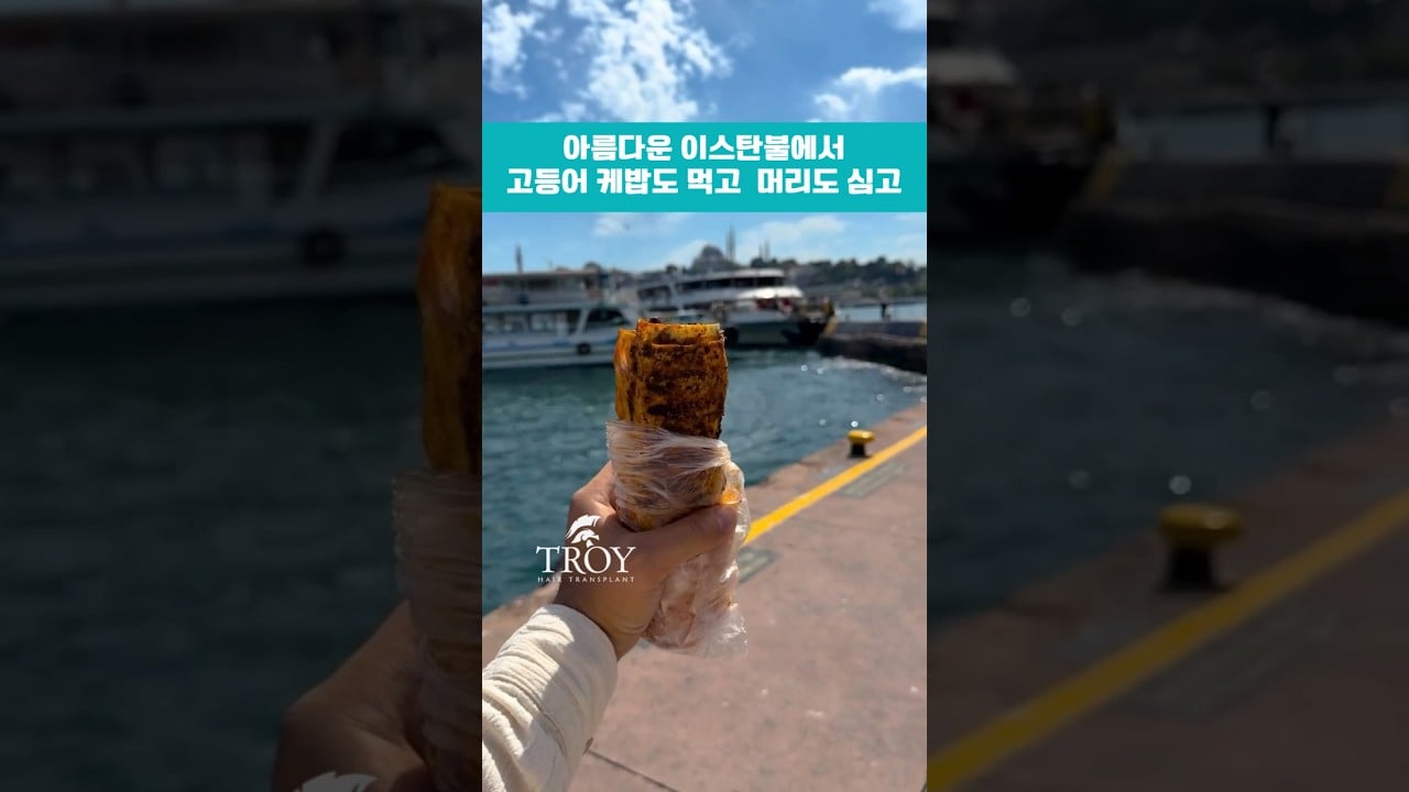고등어 케밥도 먹고 머리도 심고 | 🇹🇷 튀르키예 모발이식 여행 | 트로이헤어