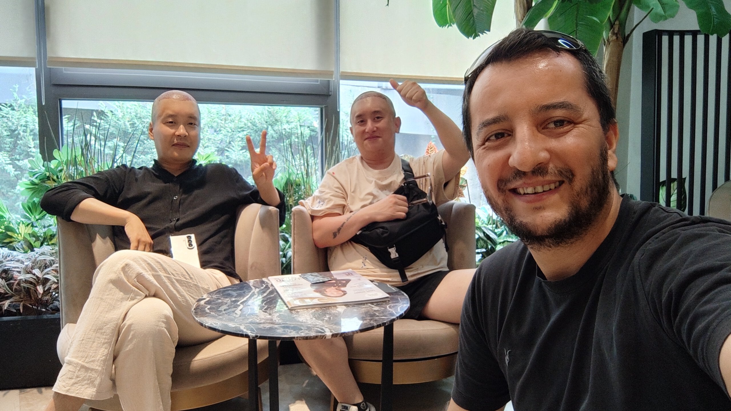Korean Hair Transplant Patients Troy Hair Scaled 트로이헤어 터키 모발이식 패키지를 이용한 한국인 환자들
